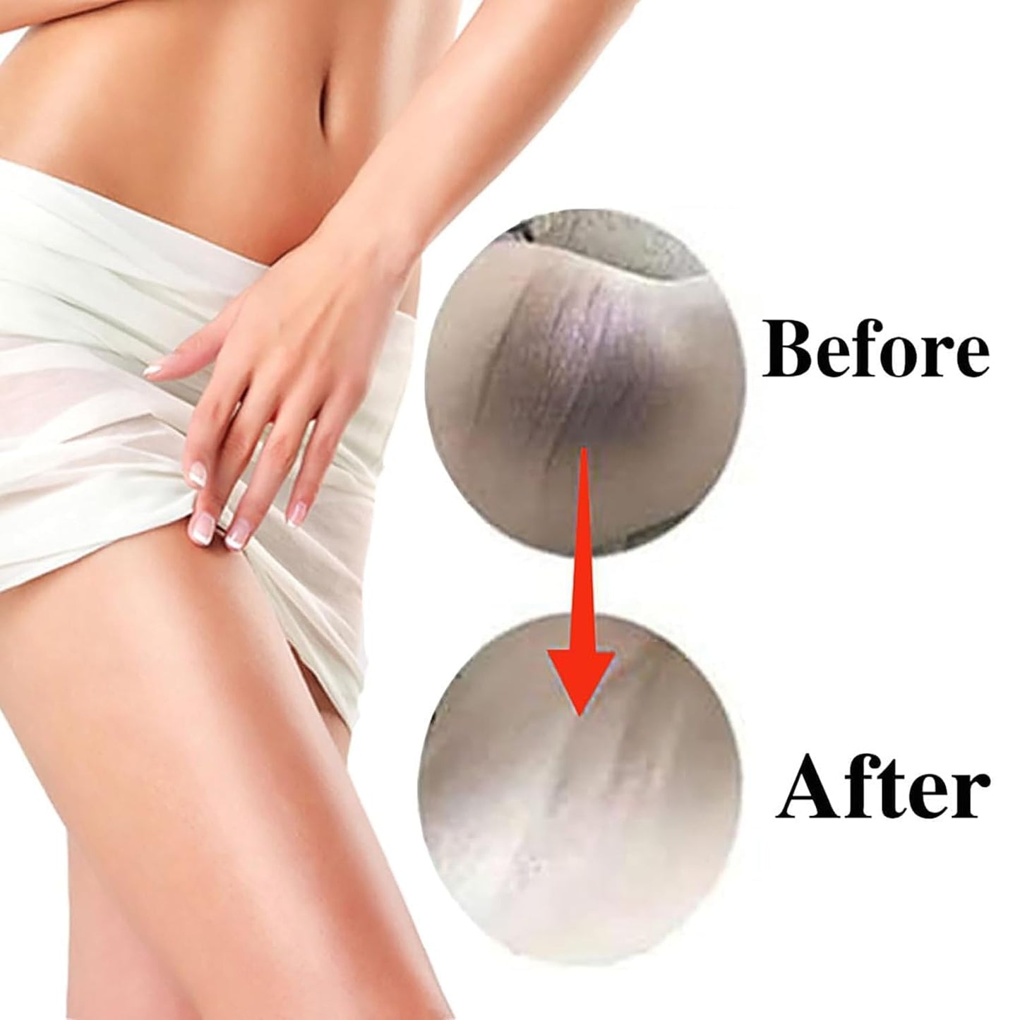 SMILEFACE Skin Lightening Serum Anal Bleach Cream with Kojic Acid, Arbutin, Vitamin C Vitamin E for Anal, Intimate Areas, Private Parts, Butt, Bikini Area, Anus, Inner Thighs.